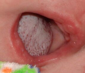 Localización de la enfermedad con un hongo