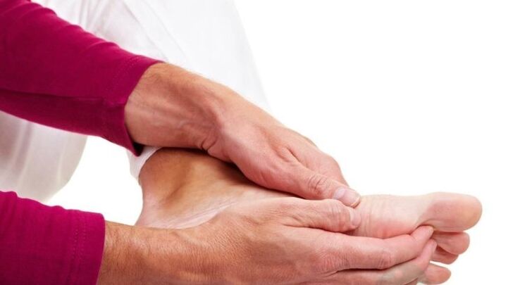 El tratamiento casero contra los hongos es aceptable en la etapa inicial.